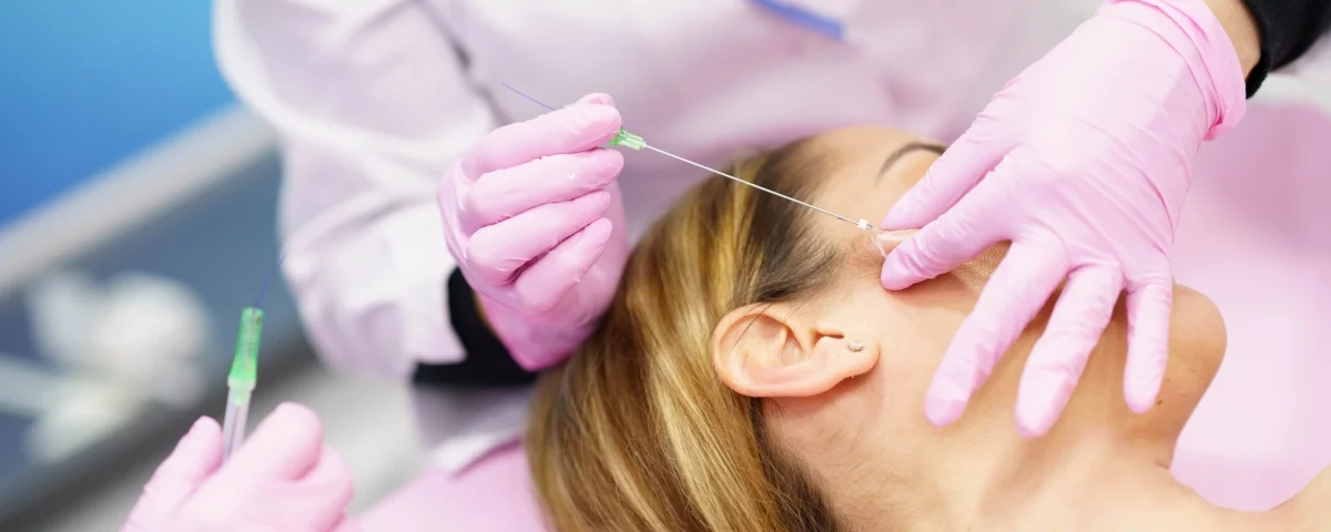 PDO Threads procedure in Salem, NH targeting eye-area wrinkles.