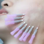 PDO Thread Lifts in Salem, NH