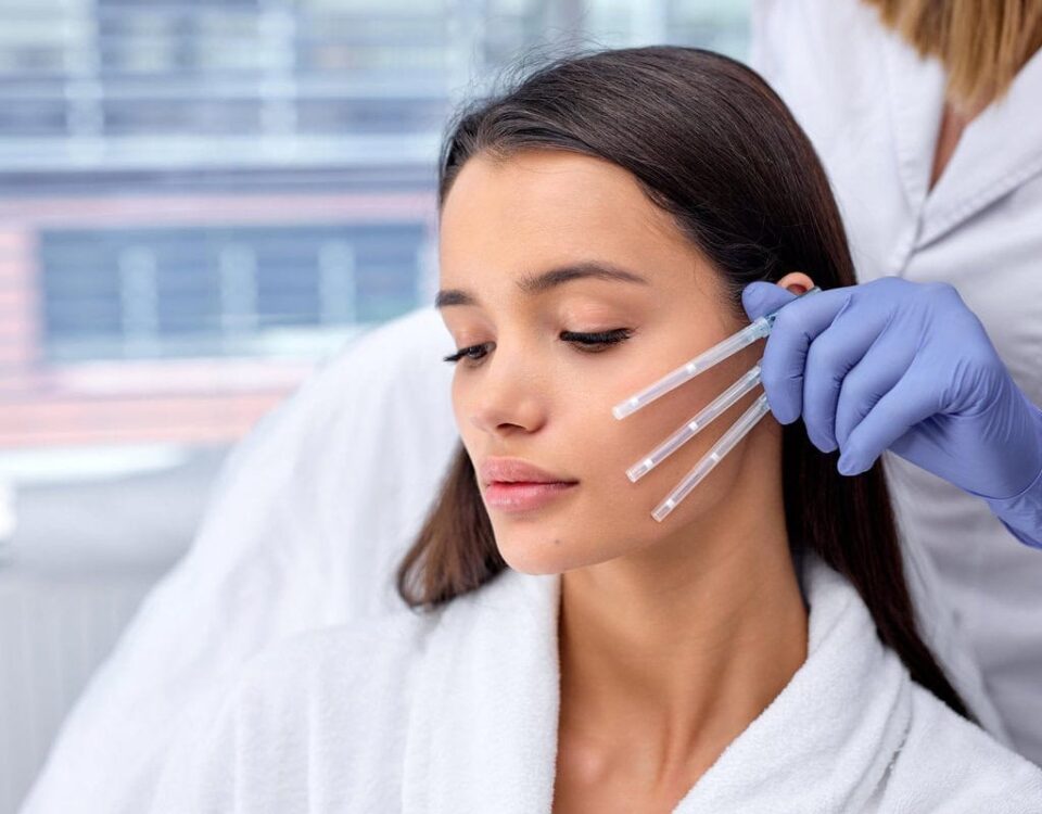 PDO Thread Lift | JSJ Aesthetics | Salem, NH and Methuen, MA