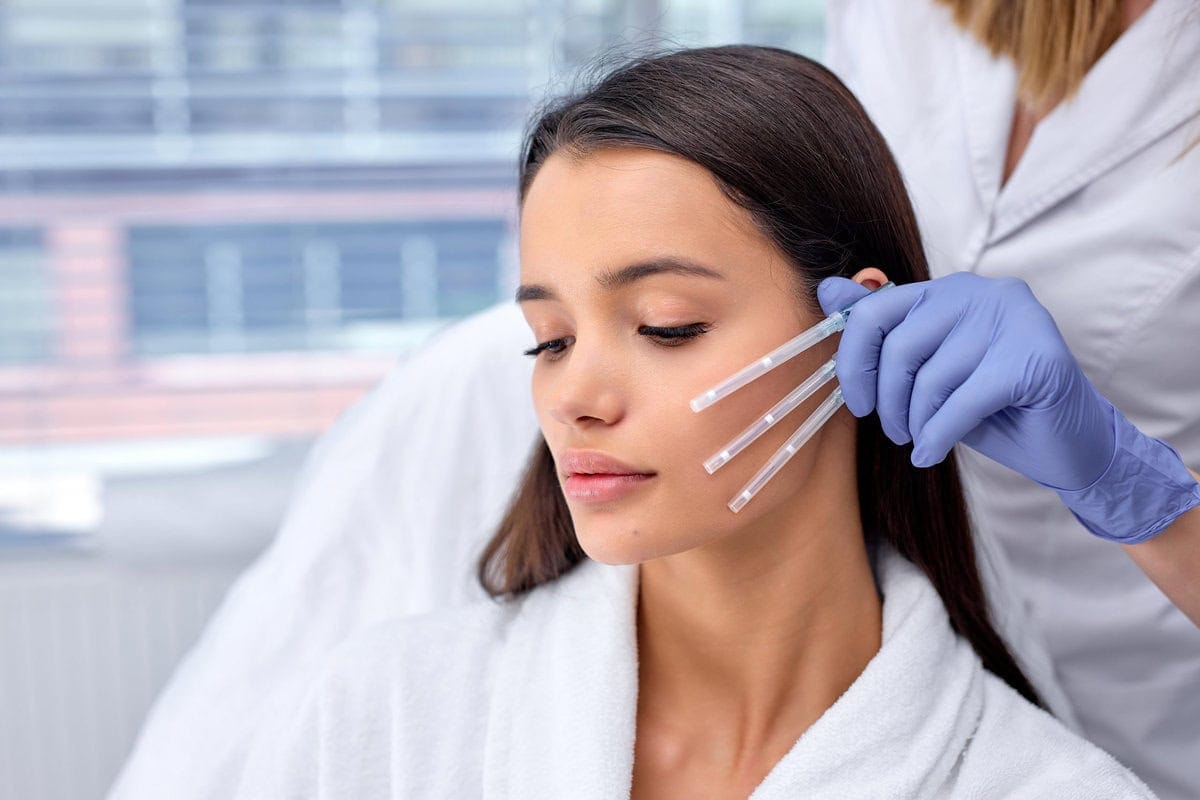 PDO Thread Lift | JSJ Aesthetics | Salem, NH and Methuen, MA