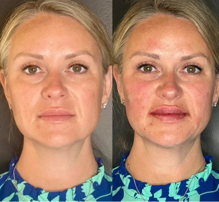 a woman with a comparison of her face