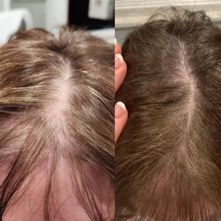 a collage of a woman's head