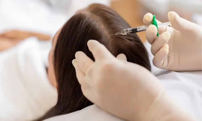 A professional aesthetic treatment session for hair restoration using natural growth factor injections in Salem, NH